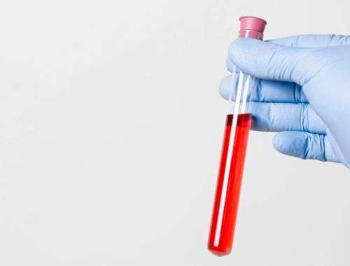 Laboratorijske pretrage poliklinika image lobby