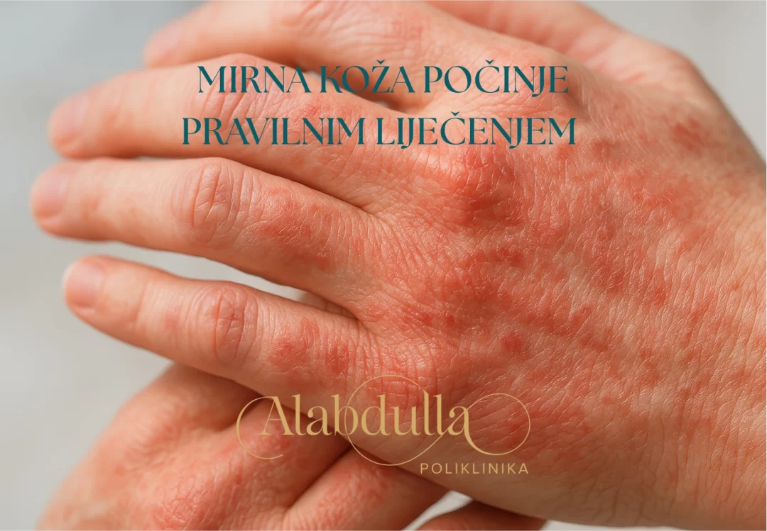 Dermatologija sada u Poliklinici Alabdulla